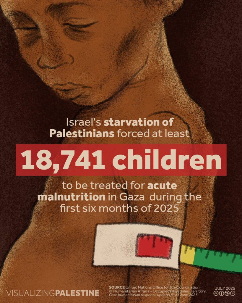 An illustrated image showing a malnourished Palestinian child with eyes closed and ribs visible, looking down with a somber expression. A measuring tape and a red malnutrition band encircle the child's upper arm, indicating severe undernourishment. The central text reads: "Israel's starvation of Palestinians forced at least 18,741 children to be treated for acute malnutrition in Gaza during the first six months of 2025." The graphic is branded with Visualizing Palestine and cites data from the United Nations Office for the Coordination of Humanitarian Affairs. Dated July 2025.